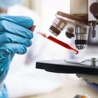 Best Stem Cell Therapy in India