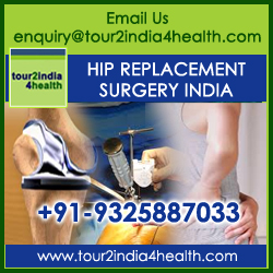 Hip Replacement Surgery in India